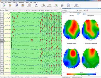 Mapovanie EEG aktivity